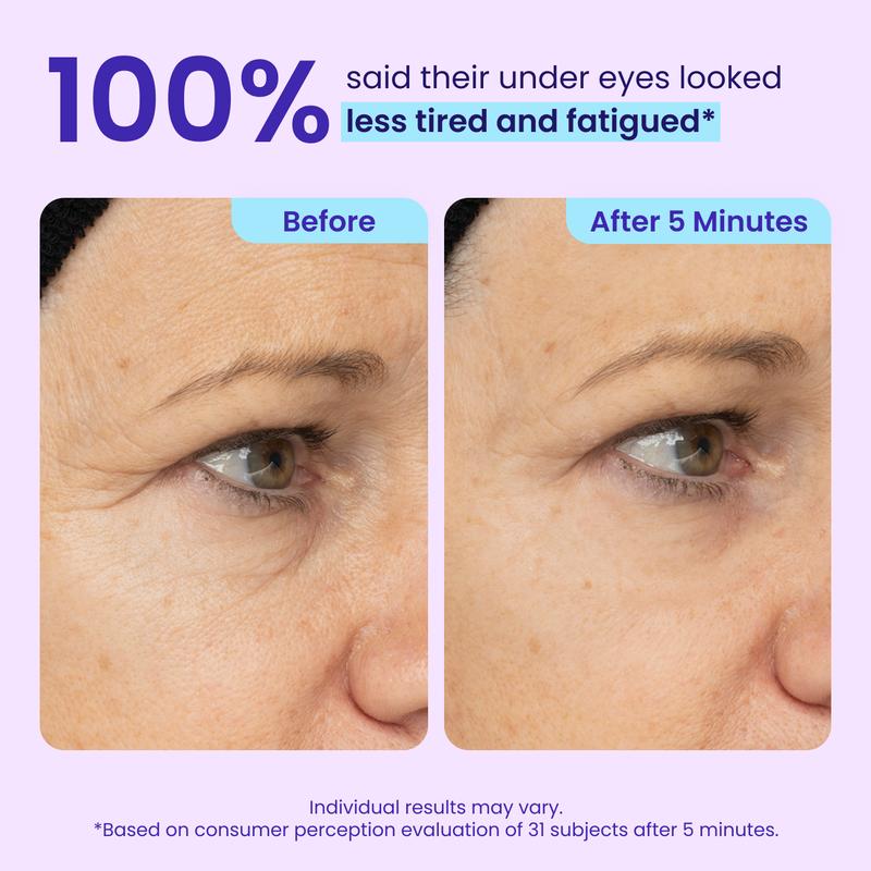 Elvara Instant Eye Lifting Gel