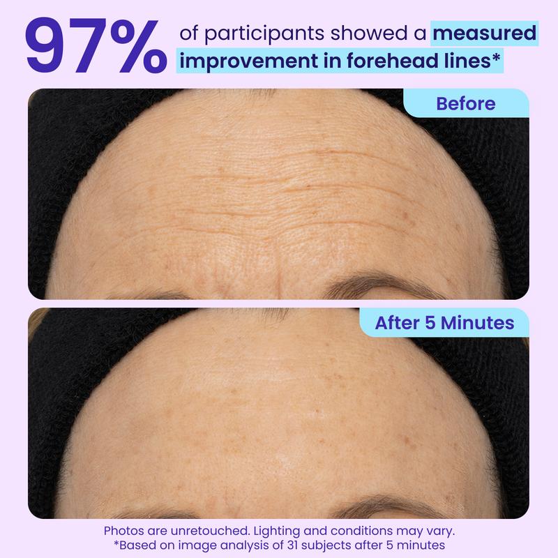 Elvara Instant Eye Lifting Gel